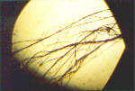 Polymerfiber-F�den unter Mikroskop, aus HP von Carnicom