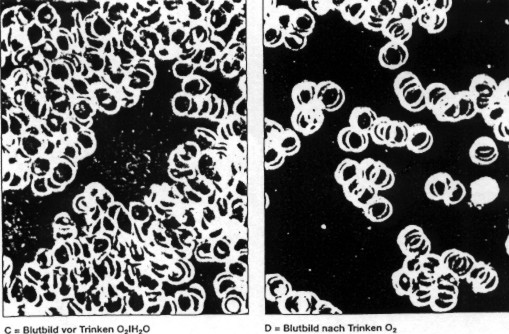 Blutbild vor/nach dem Trinken unseres Sauerstoffwassers