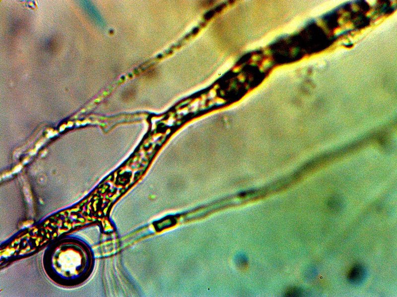 Morgellon-CDB-Heterozyten-5000x