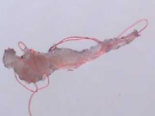rote Fibern, die aus der dunklen Kruste herauswachsen und an anderer Stelle wieder in die Haut eindringen, was bei raschem Eindringen Stichschmerz erzeugen kann. Bildquelle: www.dpref.com/fibers.html